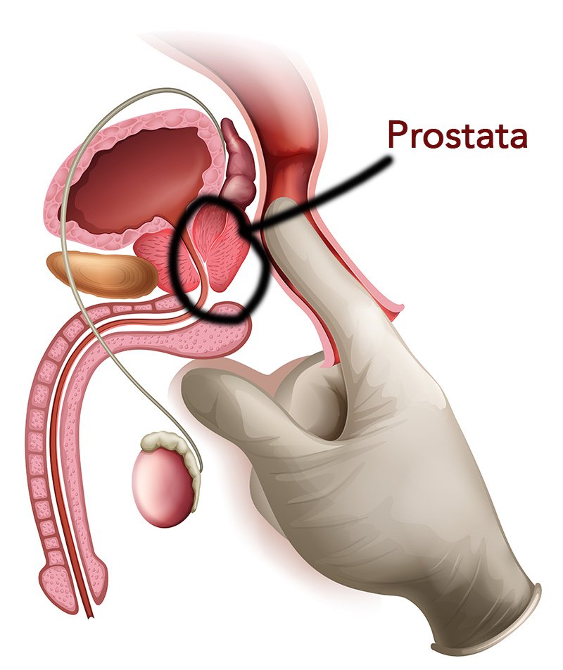 wo-ist-die-prostata